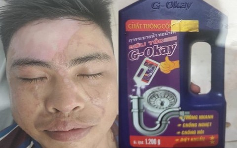 Dùng nước thông cống siêu tốc, nhiều người bỏng phải nhập viện cấp cứu