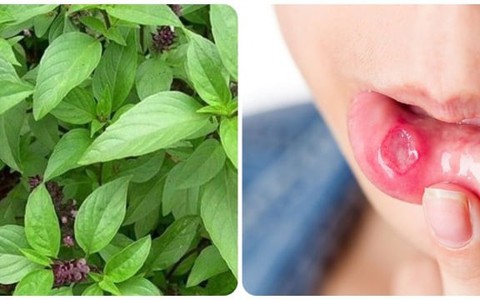 Bị nhiệt miệng nên ăn gì để nhanh khỏi?