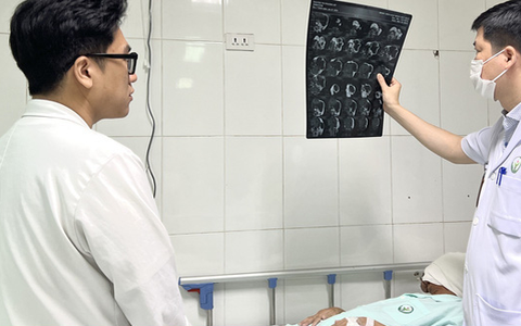 Phẫu thuật khối u khổng lồ vùng mặt cho nữ bệnh nhân 40 tuổi