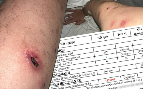 Chàng trai 24 tuổi nhiễm HIV giai đoạn cuối quyết tâm làm lại cuộc sống