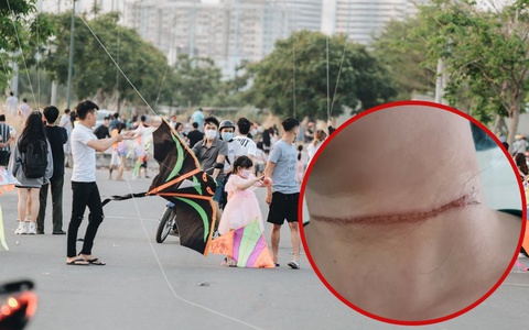 Nhiều người suýt mất mạng vì dây vắt ngang đường: Cảnh báo nguy cơ tai nạn từ những cánh diều "vô chủ"