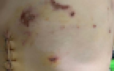 Chó nuôi cắn thủng bụng bé 4 tuổi ở An Giang