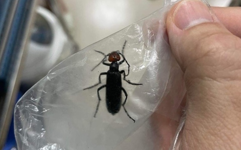 3 bệnh nhân nguy kịch sau khi ăn sâu ban miêu