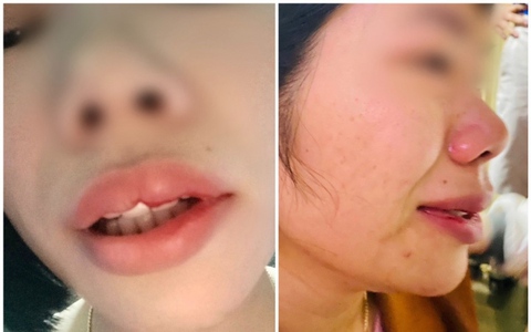 Xử phạt hành chính thầy giáo xông vào nhà hành hung nữ đồng nghiệp ở Đắk Nông