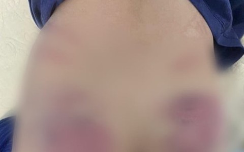 Công an Hà Nội xác minh nghi vấn cháu bé 9 tuổi bị cô giáo dạy can thiệp bạo hành
