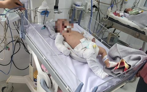 5 lần bị bạo hành dã man khiến bé gái 2 tháng tuổi chấn thương sọ não, gãy đa xương