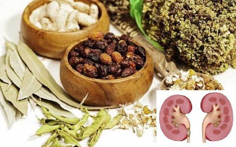 Suýt mất quả thận vì tự ý điều trị sỏi thận bằng thuốc đông y