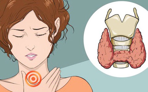 Xuất hiện 10 dấu hiệu sau chứng tỏ tuyến giáp đang hoạt động kém, cẩn trọng với bệnh suy giáp