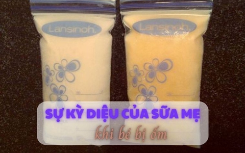 Sốc với bức ảnh về sự thay đổi kỳ diệu của sữa mẹ khi bé bị ốm