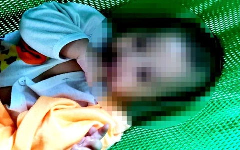 Bé trai bị bạo hành dập não ở quận Bình Tân đã qua đời