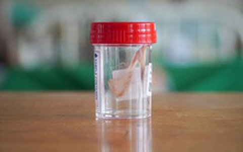 Nguy kịch vì tìm người "đẻ ngược" vuốt hóc xương