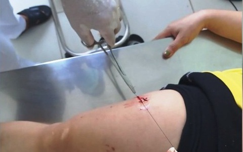 Lời hứa "việc nhẹ, lương cao": Nhiều cạm bẫy chực chờ đến vật lộn để giữ được mạng sống