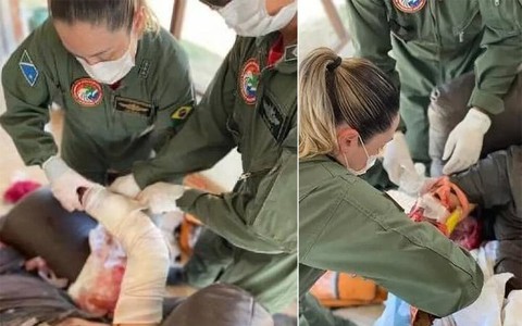 Thoát chết nhờ điện thoại trong túi quần bỗng nhiên phát nổ