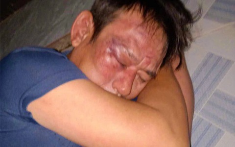 Vụ người đàn ông bị đánh do lên Facebook làm thơ: Hoàn cảnh gia đình nạn nhân khó khăn, kinh tế chỉ đủ ăn