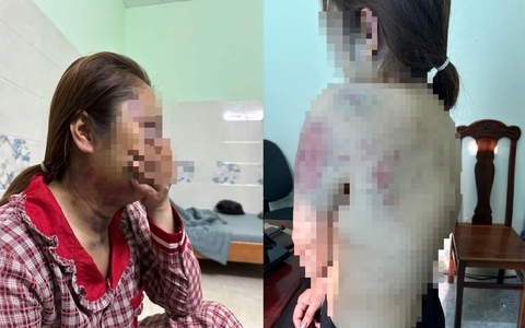 Điều tra việc người phụ nữ bị "chồng hờ" nhốt, bạo hành liên tục 13 giờ