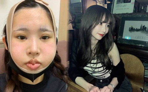 Bị người yêu cũ chê bai ngoại hình, cô gái chi 3,2 tỷ đồng để "lột xác" và cái kết gây bất ngờ