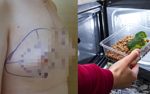 Thích ăn đồ hâm nóng trong lò vi sóng kiểu này nhiều năm, người đàn ông có ngực như phụ nữ