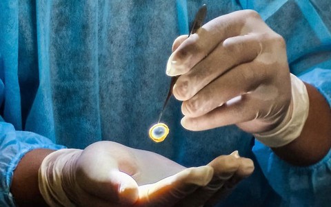 Cụ ông 86 tuổi là người hiến tặng giác mạc đầu tiên ở Hoà Bình