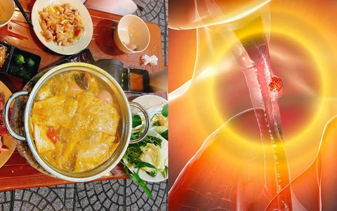 Ăn lẩu theo 2 kiểu này cực độc hại, kiểu số 1 được ví như "công tắc bật" ung thư, mùa đông nhiều người mê