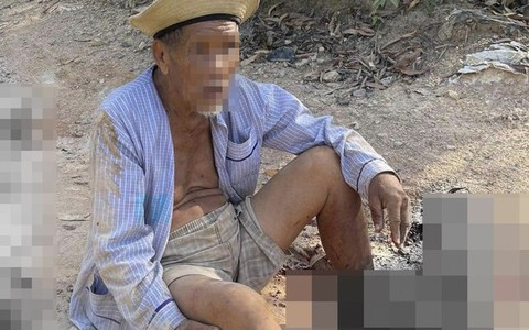 Truy tìm chiếc xe tông dập nát hai bàn chân cụ ông 85 tuổi rồi bỏ trốn
