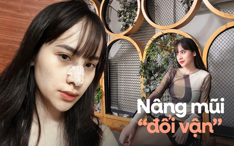 Hành trình nâng mũi "đổi vận" của cô gái 9x: Được cả gia đình "tháp tùng" đi thẩm mỹ và nhan sắc thay đổi bất ngờ