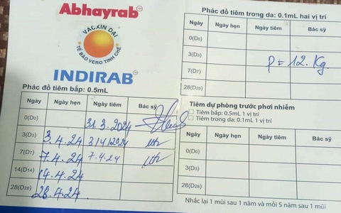 Bắc Giang: Bé gái 2 tuổi tử vong sau hơn nửa tháng bị chó lạ cắn vào mắt trái