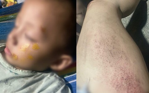 Xót xa cảnh người mẹ chở con 19 tháng bị cướp lúc nửa đêm, ngã xuống đường