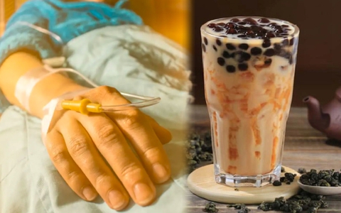 Cô gái 28 tuổi bị suy thận giai đoạn cuối vì sở thích uống trà sữa mỗi ngày suốt 10 năm