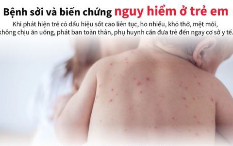 Số ca sốt phát ban nghi sởi tăng 2,7 lần so với cùng kỳ năm 2023