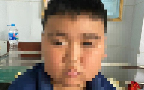 Dùng thuốc quá liều, bé trai 13 tuổi suy thượng thận