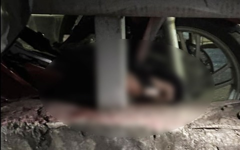 Người đàn ông đứt lìa bàn chân sau tai nạn, xe máy "vắt vẻo" trên dải phân cách