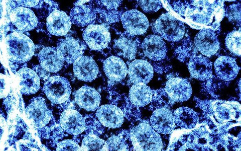 Biến thể phụ KP.2 của virus SARS-CoV-2 có thể lây lan nhanh hơn và 'né' miễn dịch tốt hơn