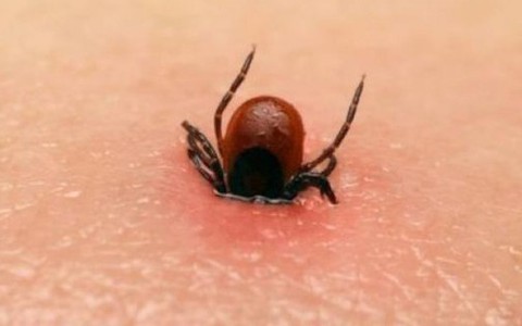Bác sỹ cảnh báo vết đốt nhỏ từ côn trùng cũng có thể gây chết người