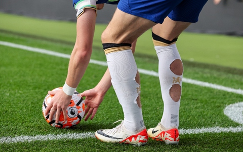 Những chiếc tất khoét lỗ kỳ lạ của cầu thủ Anh ở Euro 2024: Xu hướng thời trang hay có bí mật đằng sau?