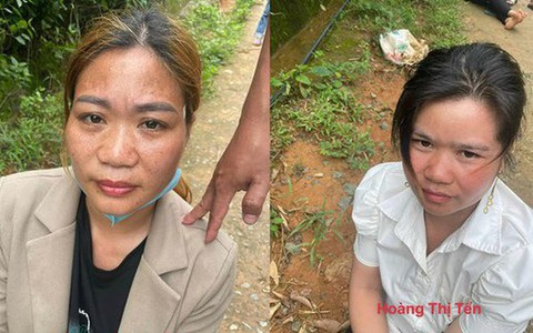 Bắt nhóm phụ nữ thường xuyên uống rượu say rồi mua ma túy về sử dụng