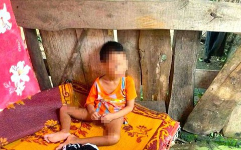 Bé 5 tuổi có nhiều vết thương bị đưa ra ở riêng trong lán tạm