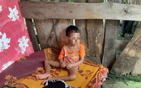 Thực hư việc "bé 5 tuổi có nhiều vết thương bị bỏ rơi trong lán tạm" ở Nghệ An
