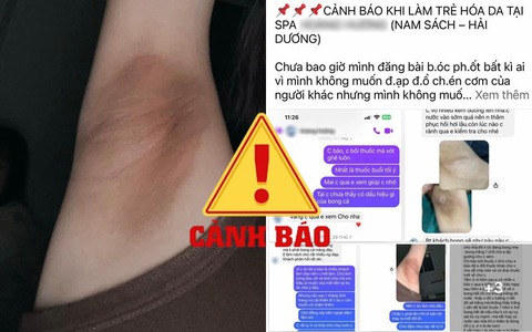 Bỏ 3 triệu trị thâm nách tại spa, tôi đã nhận cái kết đắng: Da bỏng rát, bong tróc nguyên 1 tháng không đỡ
