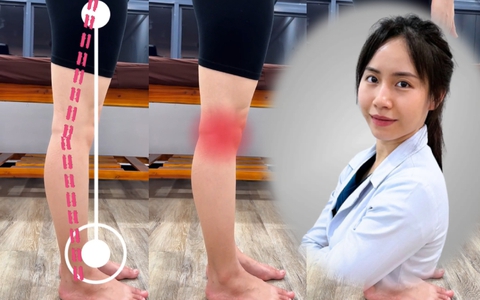 Bài tập cải thiện tình trạng ưỡn gối, cong chân: Chăm tập mỗi ngày chị em sớm có chân thẳng, tránh thoái hóa khớp gối
