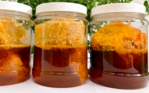 Cùng anh trai 7 tuổi uống 1/3 chai rượu ngâm mật ong, bé gái hơn 3 tuổi bị ngộ độc