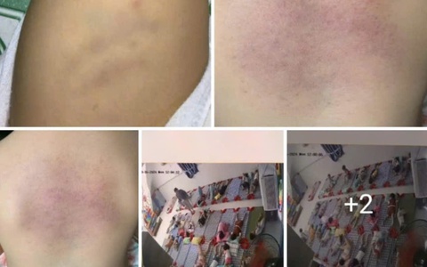 Công an xác minh hình ảnh nghi bạo hành trẻ tại nhà trẻ tư thục