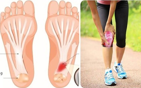 Tác hại của việc đi bộ quá nhiều