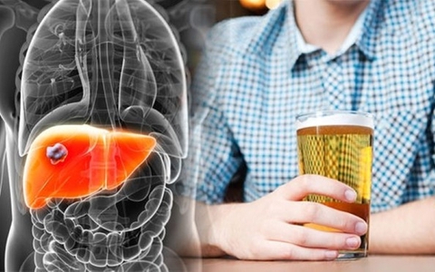 5 loại nước tàn phá gan nhanh hơn cả rượu bia, nhiều người vẫn uống hàng ngày
