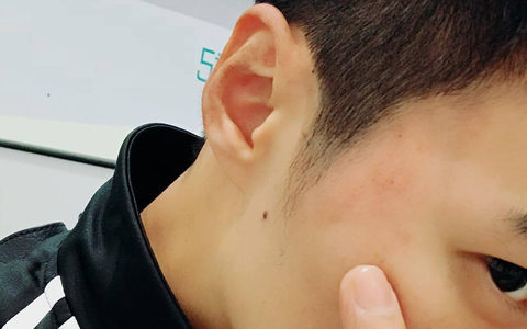 Nhuộm tóc 4 lần 1 tháng, người đàn ông nhận kết quả bất ngờ
