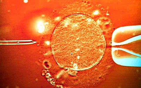 67 trẻ sinh ra từ tinh trùng người hiến mang gene ung thư, 10 trẻ mắc bệnh