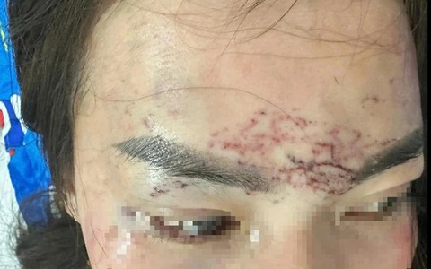 Khởi tố vụ bắt người phụ nữ đem về xăm, cắt tóc và đánh đập gây chấn động dư luận ở Cà Mau