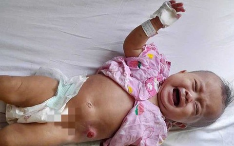 Ánh mắt cầu cứu của bé gái 6 tháng tuổi bị dị tật bẩm sinh, không tiền cứu chữa