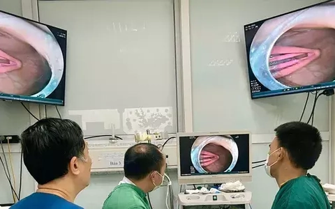 Bé 21 tháng tuổi nuốt kẹp tóc vào bụng, lời cảnh báo với các phụ huynh