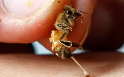 Dùng ong đốt để điều trị ung thư, người phụ nữ phải cắt bỏ cả hai bên ngực