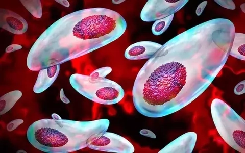 Một loại ký sinh có thể cắt đứt tinh trùng của con người, nguyên nhân gây vô sinh toàn cầu?
